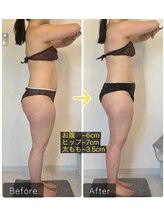 エメカシワ(Aimer KASHIWA)/1ヶ月での変化