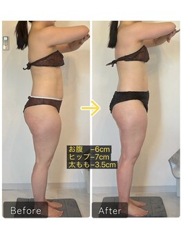 エメカシワ(Aimer KASHIWA)/1ヶ月での変化