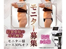 ラディアンス