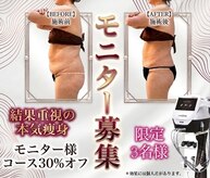 ラディアンス