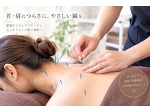 まつもと接骨院 龍ケ崎院本院の雰囲気（頭痛/肩こり/鍼施術//首こり/眼精疲労/自律神経の乱れ/龍ケ崎）