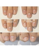 ニコプラス(NICO+)/ジェルネイルができない方向け