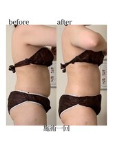 オン(On)/美ボディ☆シルエット美人