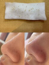 サロンこころ/1回でこの効果！毛穴ケア