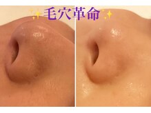 トータルビューティーサロン 凛の雰囲気（目指せ毛穴レスのお肌♪）