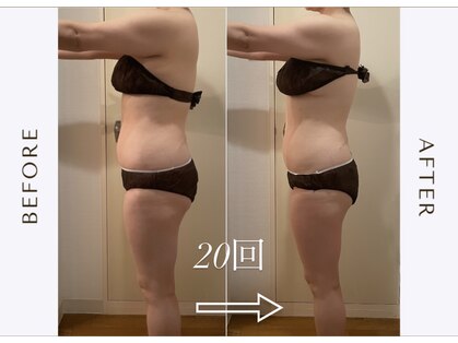 ヨサパーク レナータ(YOSA PARK Renata)の写真