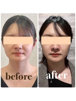 クリーム 京都店(Cream)/