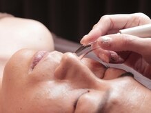 ラビ(Rabi)/メンズフェイシャルエステ