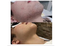 ティーニ 春日井店(TINI)/【before→after】