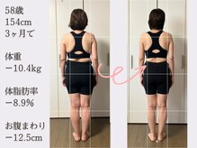 香林(KARIN)/ビフォーアフター