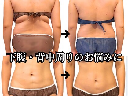 癒和(YUWA)の写真