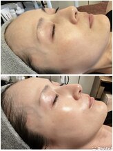 private salon Ponola【ポノーラ】/ラミネーションピール