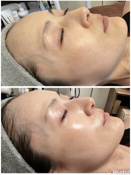 private salon Ponola【ポノーラ】/ラミネーションピール