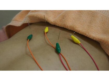 もりわき骨盤鍼灸整骨院 堺筋本町の写真