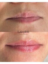 カルム(Calme)/Lalapink