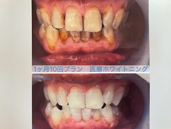 シャイニー 掛川店(shiny)/