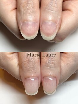 マリーロール 梅田店(Marie Laure)/自爪育成/深爪矯正/ネイルケア