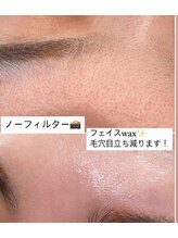 イーエム アイラッシュ(em eyelash)/くすみ肌にフェイスワックス
