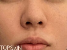 トップスキン 新宿(TOPSKIN)/専門家推奨！TCLINEの圧倒的効果