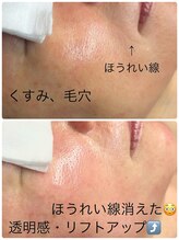 リカルム(Recalme)/50代