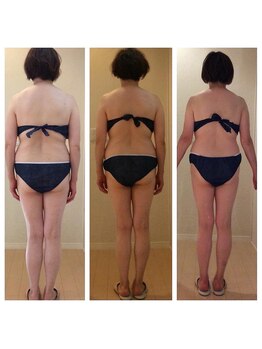 ホロニック ベルサンテ(Holonic Belle Sante)/メディセルハイブリッド