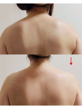 ソアン(Soan)/マッサージ付きフェイシャル