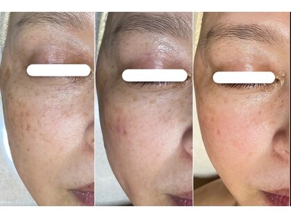 トリートメントサロンビューティープラス(Treatment Salon Beauty+)の写真