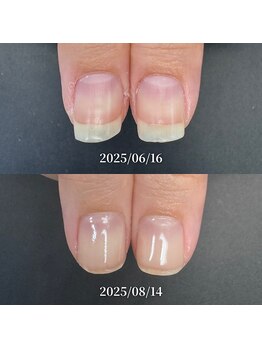 ココ(COCO)/ハンドケア・自爪育成・深爪育成