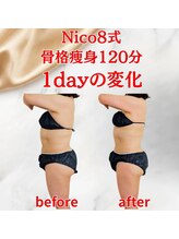 ニコエイト(Nico8)/◇Nico8式骨格痩身◇