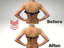 メディカルエステサロン ローズ 金沢本店(ROSE)/ドレス映え100%!!くっきり肩甲骨