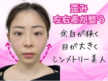 ナチュラルパーフェクトフェイス 新宿/頬骨シャープに【新宿駅小顔】