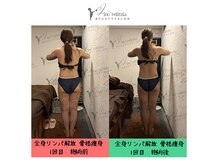 リノレリチア 心斎橋 新町店の雰囲気（施術メニュー[全身リンパ解放×骨格痩身/80分] ）