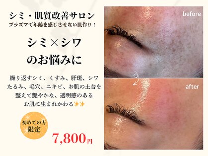 ココビ(COCOVi)の写真