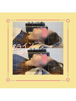 美容整体サロン プライム(Prime)/小顔矯正　ビフォーアフター