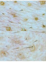 アネル 豊見城(anel)/