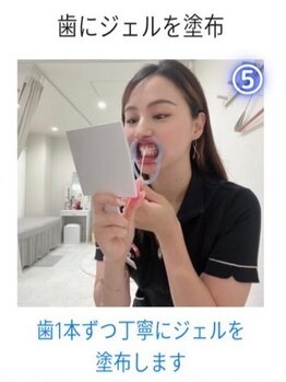 ホワイトニングショップ 成田店/【ホワイトニングの手順5】