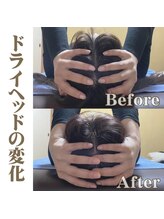 ストック(Stock)/ビフォーアフター