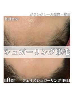 グランクレール トウキョウ(GRANDCLAIRE.TOKYO)/フェイスシュガーリング