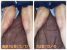 ダウンタイム回数券をお持ちの方