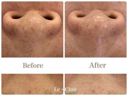 スキンセラピーサロン ル クレール(Le Clair)の写真