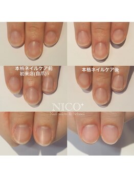 ニコプラス(NICO+)/ジェルネイルができない方向け