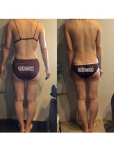 エスデザイン(es design)/リンパマッサージ／谷山エステ