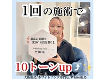ホワイトニングサロン ホワイト(WHITE)/セルフホワイトニング/大阪/福島