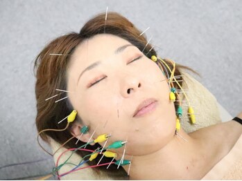 すこやか鍼灸整体院の写真/【むくみ・たるみに即アプローチ！本気の小顔矯正】貴方の理想のフェイスラインへ♪
