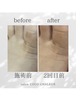 ココ シャルール(salon COCO CHALEUR)/Before　After