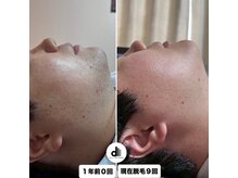 ビューティーサロン マル(Beauty Salon MARU)/