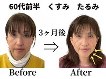 ラ キュート(LA-9TE)/ストレスのない顔に