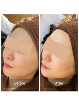 ビビ(VIVI)/ララピールで艶肌に♪