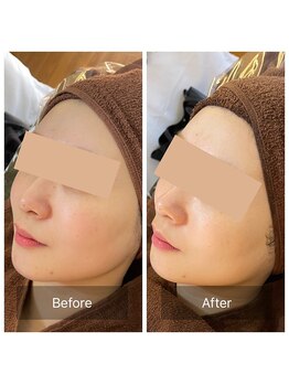 ビビ(VIVI)/ララピールで艶肌に♪