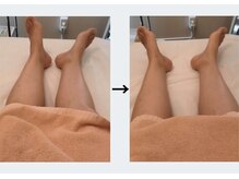 ドクターエイジレス(DR.AGELESS)/筋膜美容整体コース1回